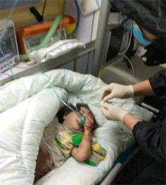 小女孩在医院接受治疗。(网络图片)