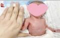 江苏省南通市一名孕妇怀孕26周生下一名“巴掌婴儿”，体重只有0.9公斤。（视频截图）