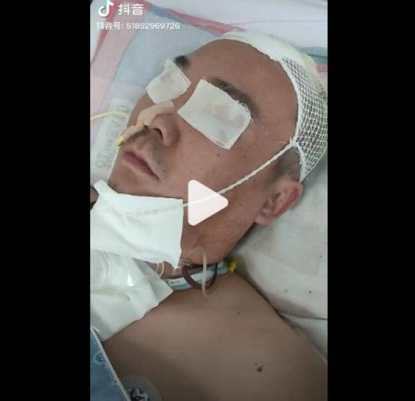 一名中年男子突发脑干出血病危。（图片来源：网路截图）