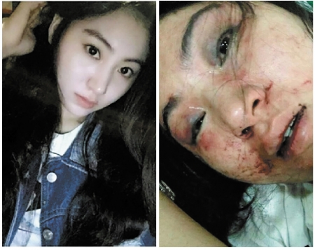 左图:小希原本是个美丽的女歌手。右图:惨遭暴打后的小希(网络图片) 左图:小希原本是个美丽的女歌手。右图:惨遭暴打后的小希(网络图片)
