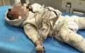 江苏1岁半婴儿不幸身亡。（图片来源：微博）