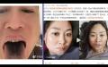 天津男子确诊后，发现舌头、牙齿都变黑。（左）；安徽女子确诊第4天，满脸变得黑糊，如同被毁容（右）。（图片来源：网络图片）