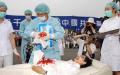 活摘演示    （图片来源: Getty Images）