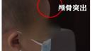 湖南郴州永兴县不少过敏儿的家长发现，自己的孩子最近不停拍且体重骤降， 头骨变成畸形的大头娃娃。（图片来源：视频截图）