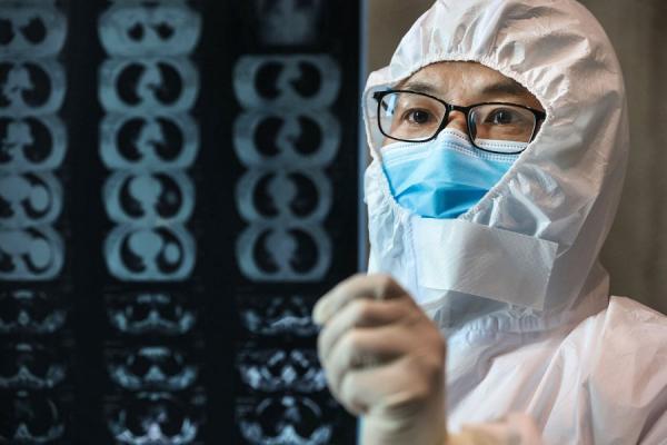 最近有法国医生留意到,感染中共病毒后,会导致出现不寻常的皮肤症状。图为医生在看确诊患者的CT图片(图片来源:Photo by STR/AFP via Getty Images)