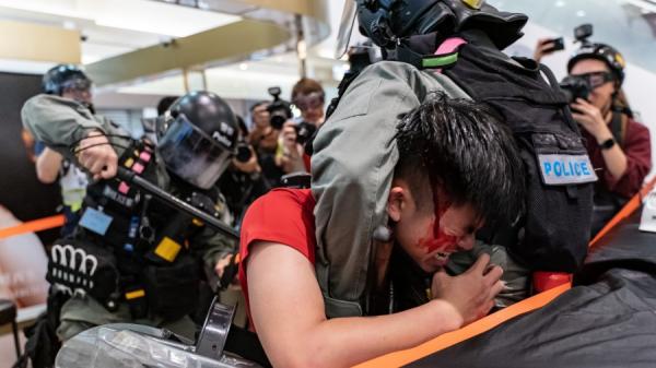 加拿大亦加入英国之列，接收来自香港的政治难民，一对香港参与反送中运动的抗争夫妇正式获批成为“公约难民”。图为反送中期间，示威者被警方暴力对待。（图片来源：Anthony Kwan/Getty Images）