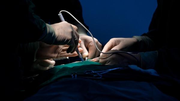 器官移植手术(示意图)。(图片来源:Getty Images)