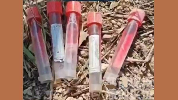 近日,中国山东枣庄市儿童福利院外发现多支病毒采样管。(图片来源:视频截图)